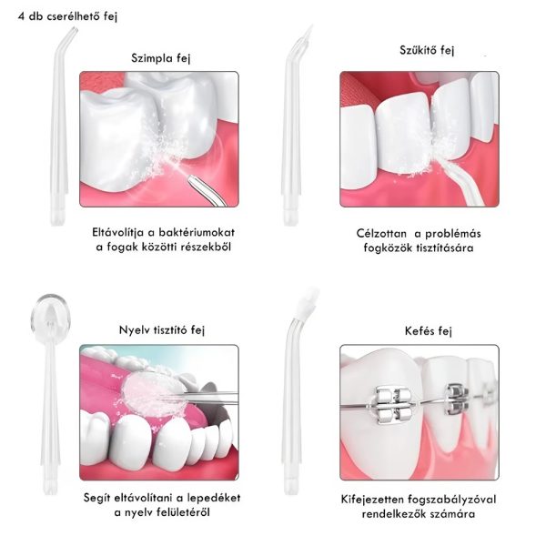 Aqua sensitive szájzuhany – 4 extra fejjel a kíméletes, alapos szájhigiéniáért (BBM) (BBV)