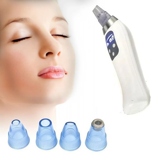 Elektromos, vákuumos pórus tisztító gép – a tökéletes megoldás a bőr tisztításához és frissítéséhez (BBV)