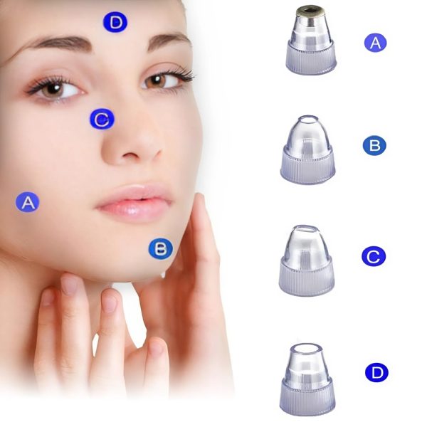 Elektromos, vákuumos pórus tisztító gép – a tökéletes megoldás a bőr tisztításához és frissítéséhez (BBV)