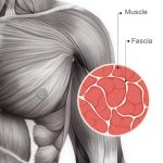 Mini3 vezeték nélküli mini masszázspisztoly - fascia fellazító masszírozó készülék 3 erősségi fokozattal és szilikon fejjel (BBV)
